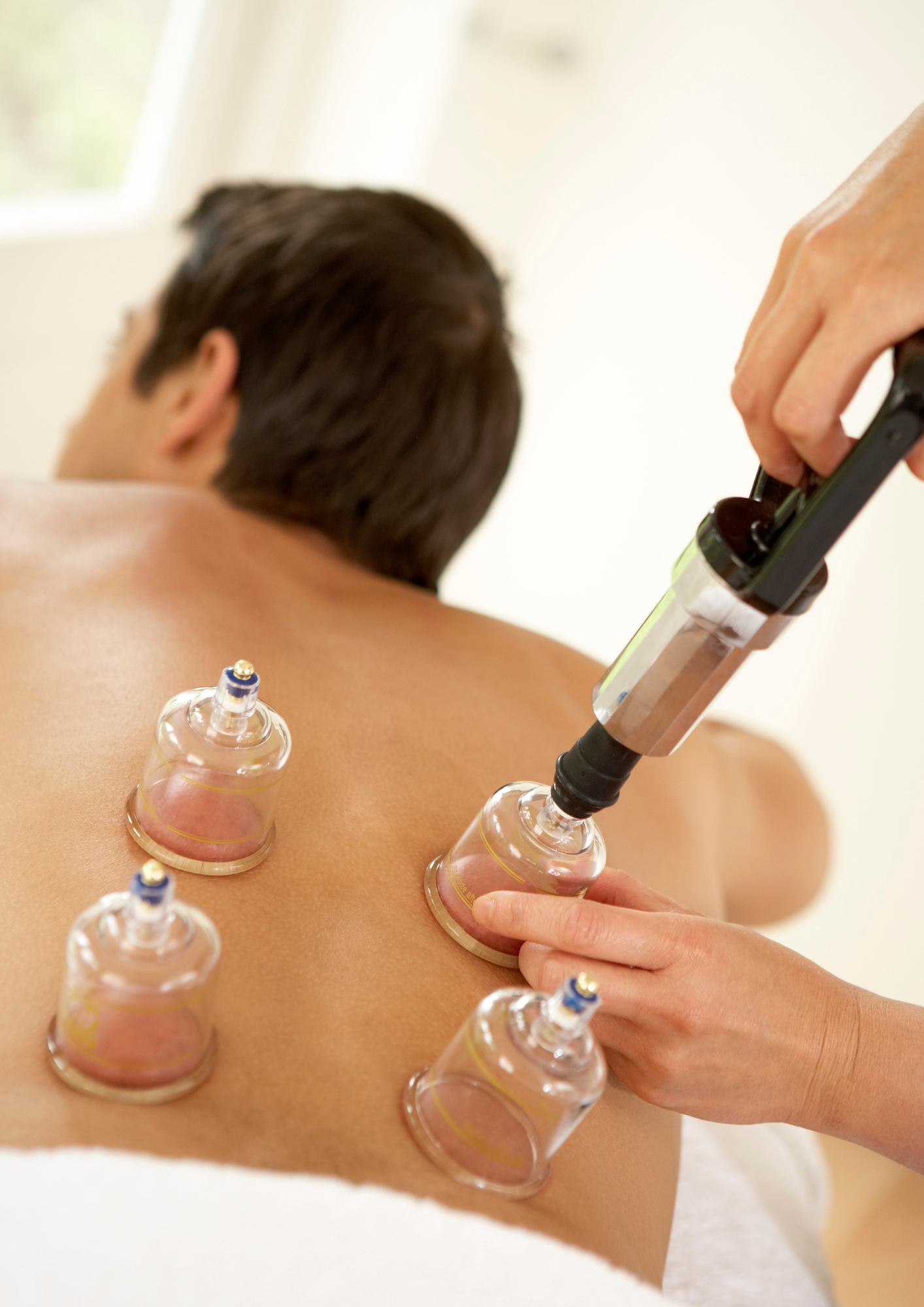 Egyptian Cupping (1)